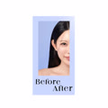 Before After
